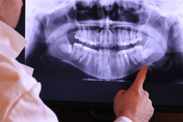 Best Emergency Gum Pain Relief  in Tracyton, WA